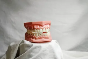 Modèle dentaire en résine illustrant l’alignement des dents après orthodontie